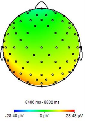 Simultaneous <mark class="highlighted">EEG-fMRI</mark> for Functional Neurological Assessment